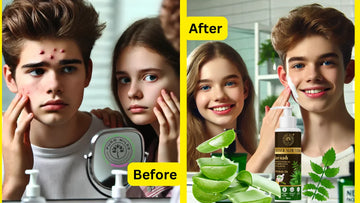 Struggling with Teen Skin? Effective Tips for a Radiant Look